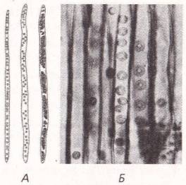 Сильно вытянутые клетки. Трахеиды под микроскопом. Трахеиды вытянутые клетки. Трахеиды сосны. Трахеи и трахеиды растения.
