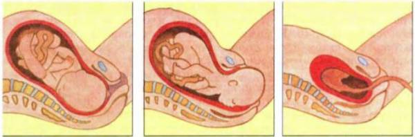 Беременность и роды 8 класс биология. Процесс рождения ребенка. Рождение ребенка схема родов.